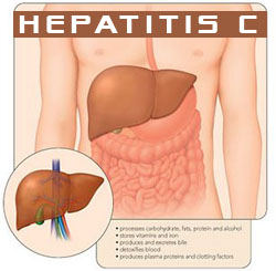 Health Care Rationing and the Politics of Hepatitis C