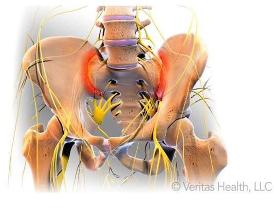 Sacroiliac Joint Pain ~ THE DOCTOR IS IN