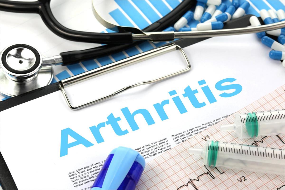 Arthritis (Osteoarthritis) ~ THE DOCTOR IS IN!